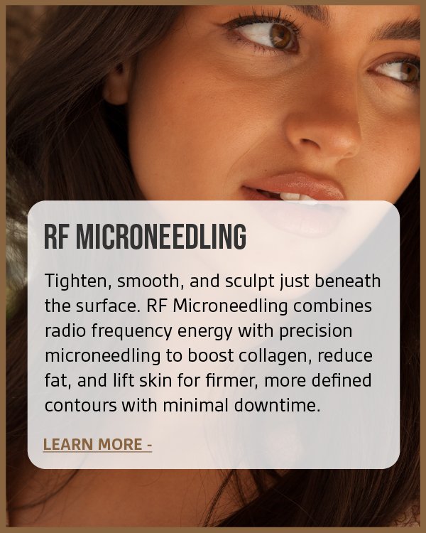 Close-up of a woman's face with brown hair and natural makeup, promoting RF Microneedling for skin tightening and contouring.